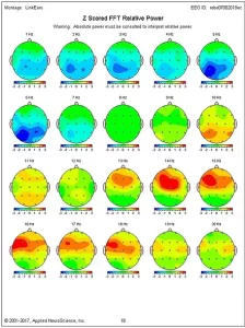 brain mapping